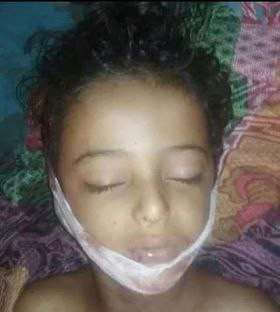 مقتل طفل بمحافظة الضالع