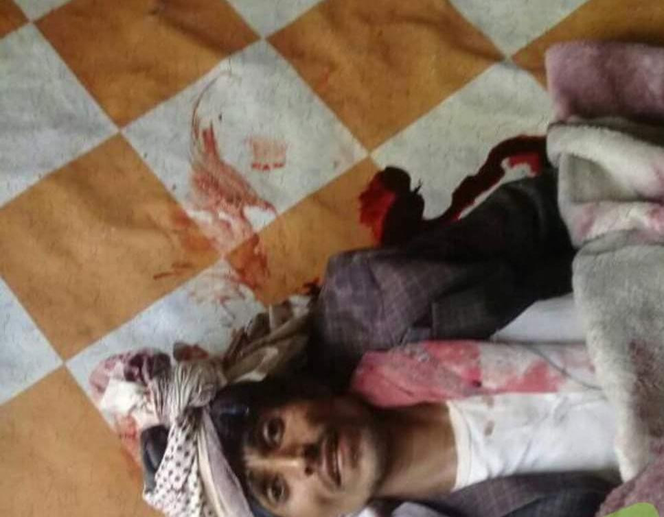 عاجل :مسلح يقتل شابا بسبب رفضه اعطائه 1000 ريال في إب(صورة)